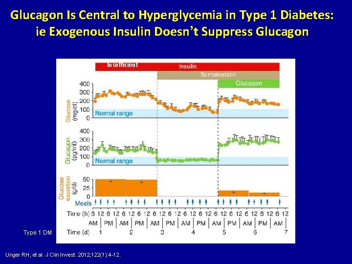 Glucagon Is Central to Hyperglycemia in Type 1 Diabetes: ie Exogenous Insulin Doesn’t Suppress