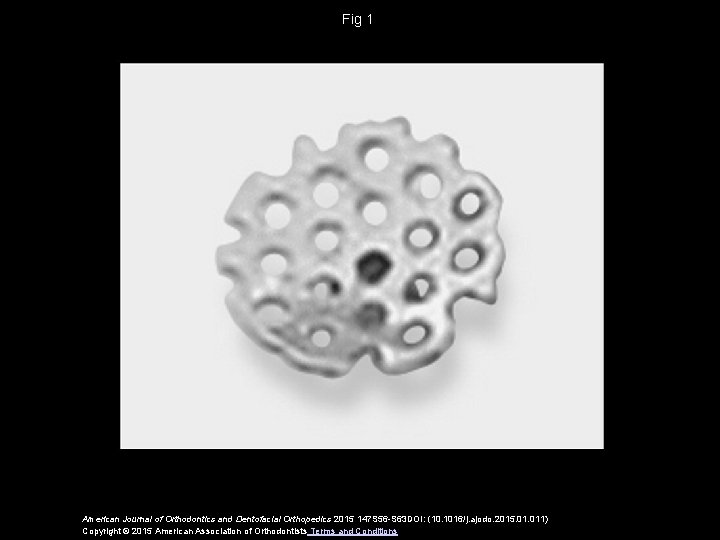 Fig 1 American Journal of Orthodontics and Dentofacial Orthopedics 2015 147 S 56 -S