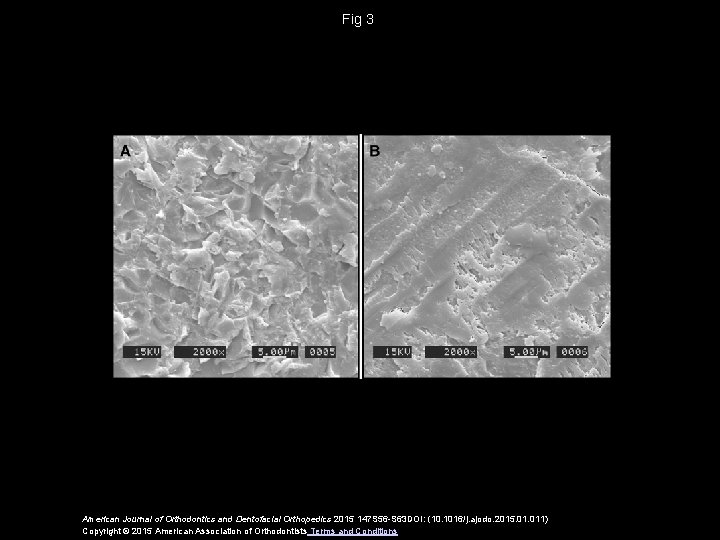 Fig 3 American Journal of Orthodontics and Dentofacial Orthopedics 2015 147 S 56 -S