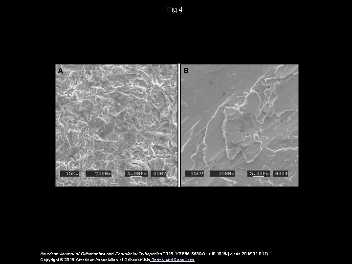 Fig 4 American Journal of Orthodontics and Dentofacial Orthopedics 2015 147 S 56 -S