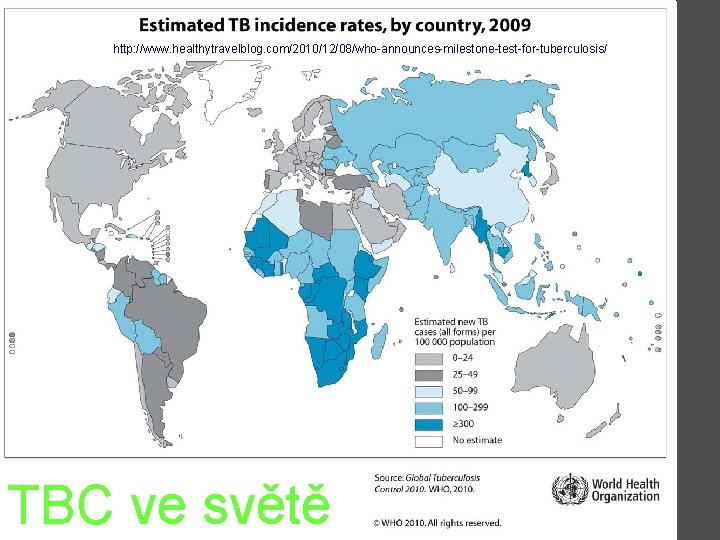 http: //www. healthytravelblog. com/2010/12/08/who-announces-milestone-test-for-tuberculosis/ TBC ve světě 