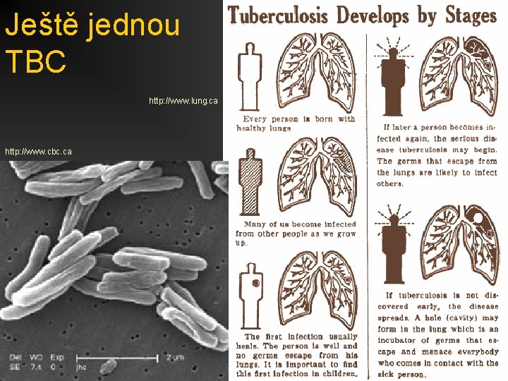 Ještě jednou TBC http: //www. lung. ca http: //www. cbc. ca 