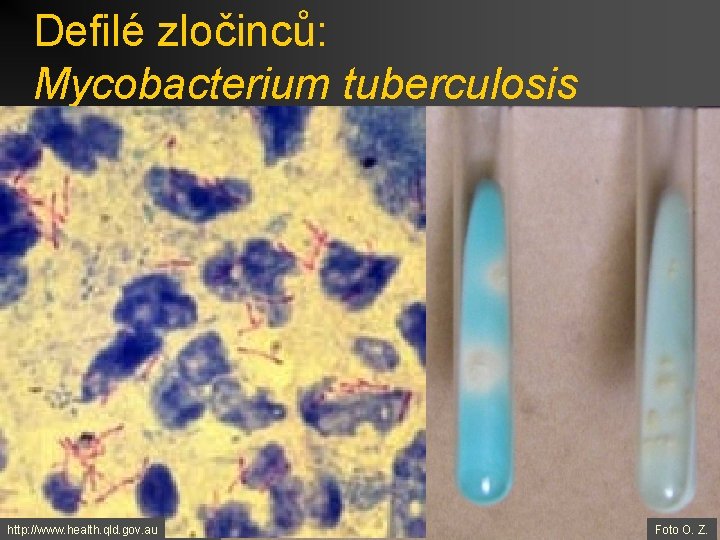 Defilé zločinců: Mycobacterium tuberculosis http: //www. health. qld. gov. au Foto O. Z. 