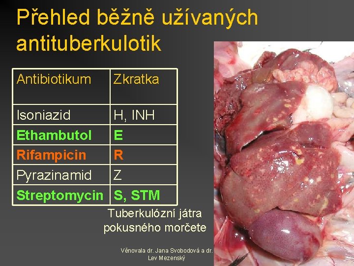 Přehled běžně užívaných antituberkulotik Antibiotikum Zkratka Isoniazid Ethambutol Rifampicin Pyrazinamid Streptomycin H, INH E