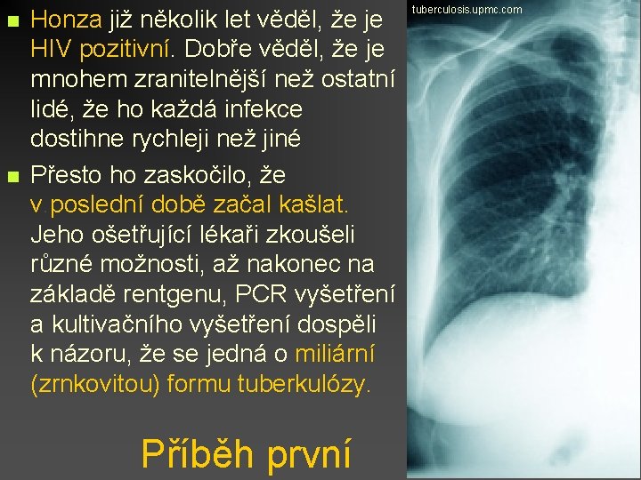 n n Honza již několik let věděl, že je HIV pozitivní. Dobře věděl, že