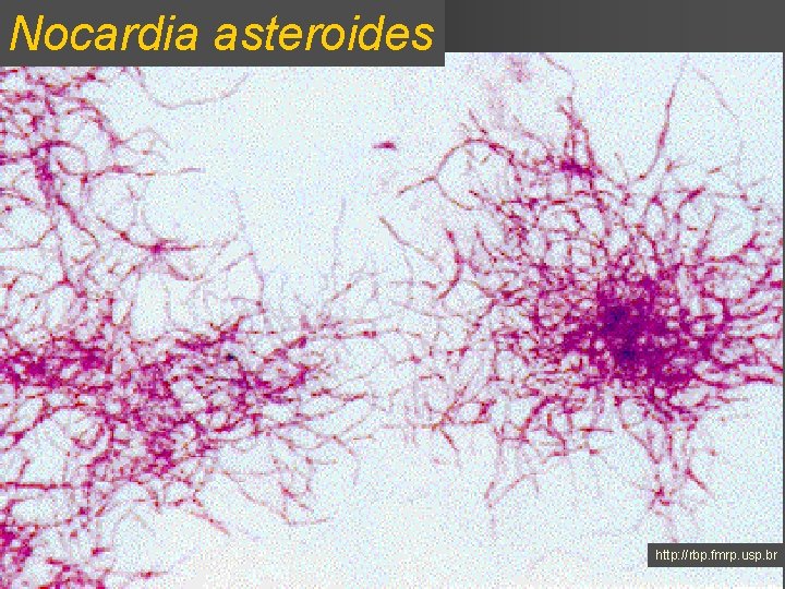 Nocardia asteroides http: //rbp. fmrp. usp. br 
