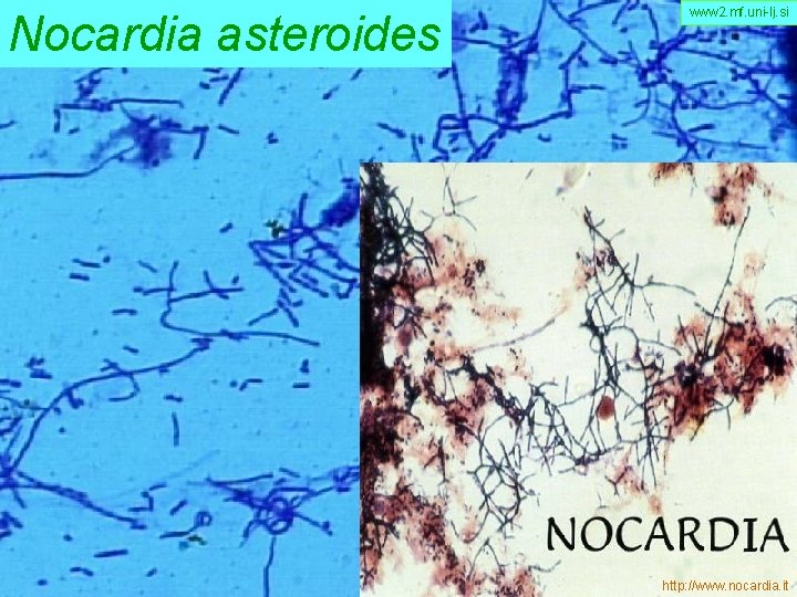 Nocardia asteroides www 2. mf. uni-lj. si http: //www. nocardia. it 