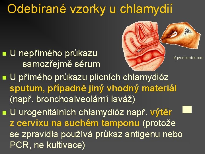 Odebírané vzorky u chlamydií n n n U nepřímého průkazu samozřejmě sérum U přímého