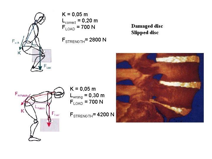 K = 0, 05 m Lcorrect = 0, 20 m FLOAD = 700 N