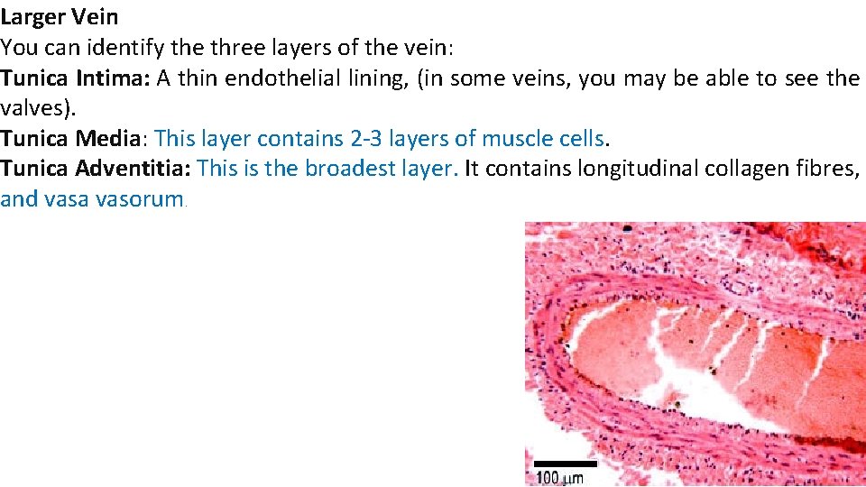 Larger Vein You can identify the three layers of the vein: Tunica Intima: A