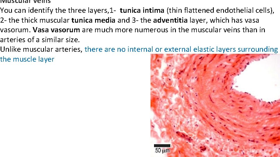 Muscular veins You can identify the three layers, 1 - tunica intima (thin flattened