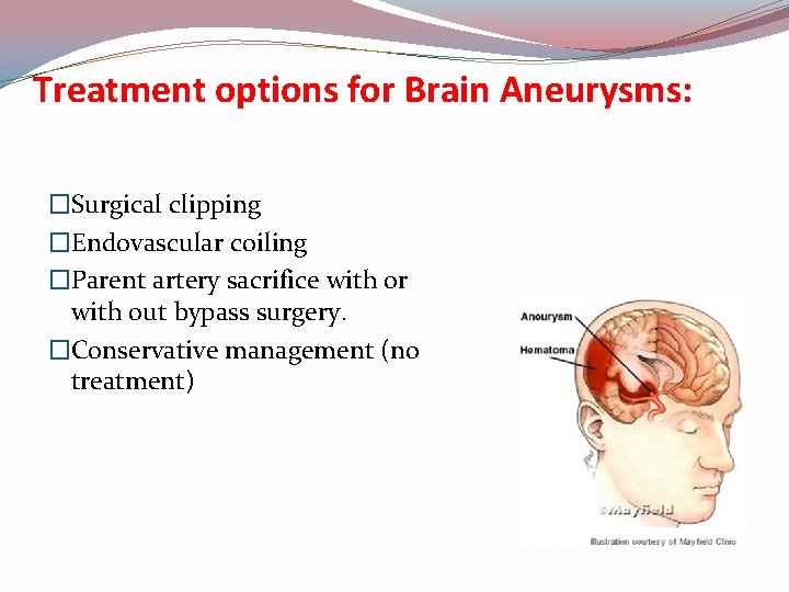 Treatment options for Brain Aneurysms: �Surgical clipping �Endovascular coiling �Parent artery sacrifice with or