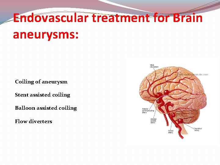 Endovascular treatment for Brain aneurysms: Coiling of aneurysm Stent assisted coiling Balloon assisted coiling