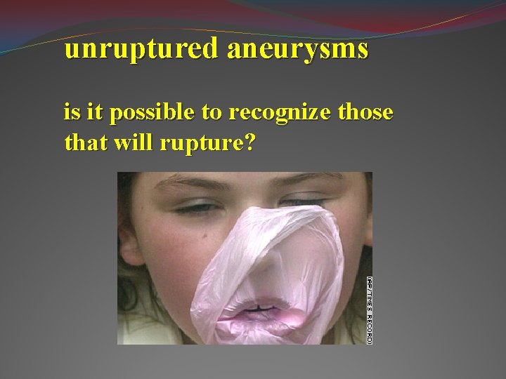 unruptured aneurysms is it possible to recognize those that will rupture? 