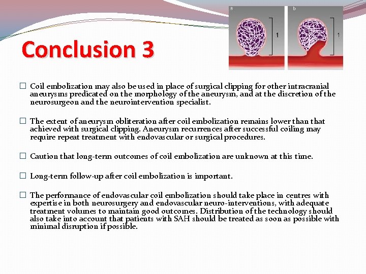 Conclusion 3 � Coil embolization may also be used in place of surgical clipping