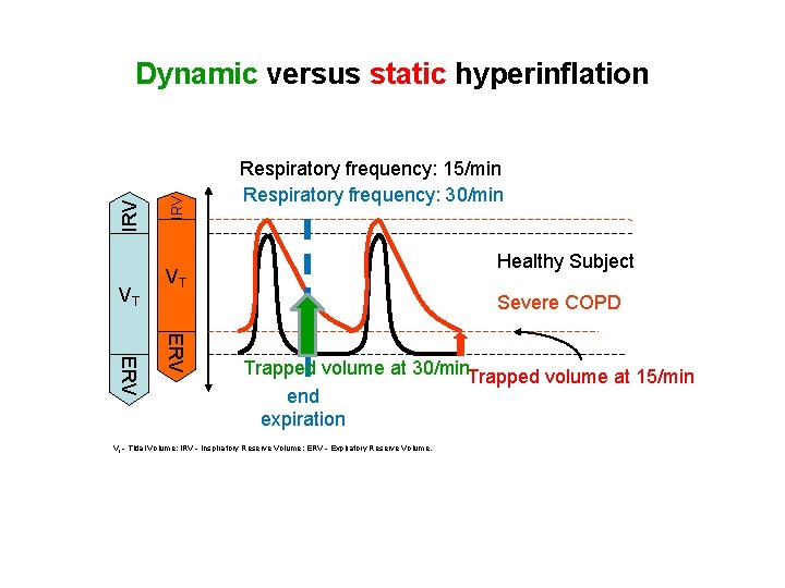 VT IRV Dynamic versus static hyperinflation Respiratory frequency: 15/min Respiratory frequency: 30/min Healthy Subject