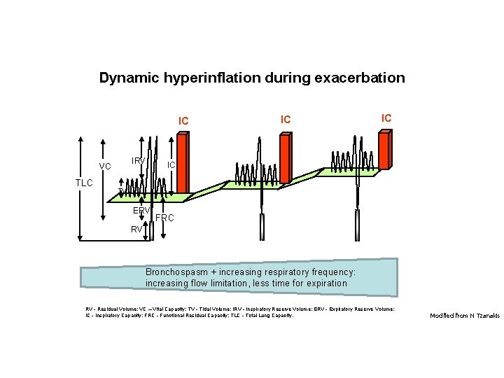 Dynamic hyperinflation during exacerbation IC IRV VC TLC IC IC IC TV ERV FRC