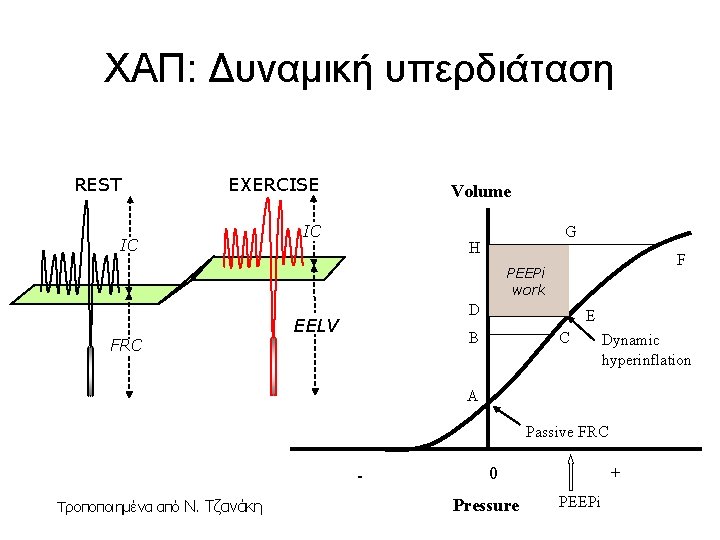 ΧΑΠ: Δυναμική υπερδιάταση REST EXERCISE IC Volume IC G H F PEEPi work D