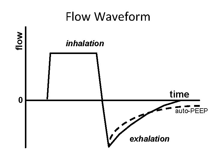 flow Flow Waveform inhalation time 0 auto-PEEP exhalation 