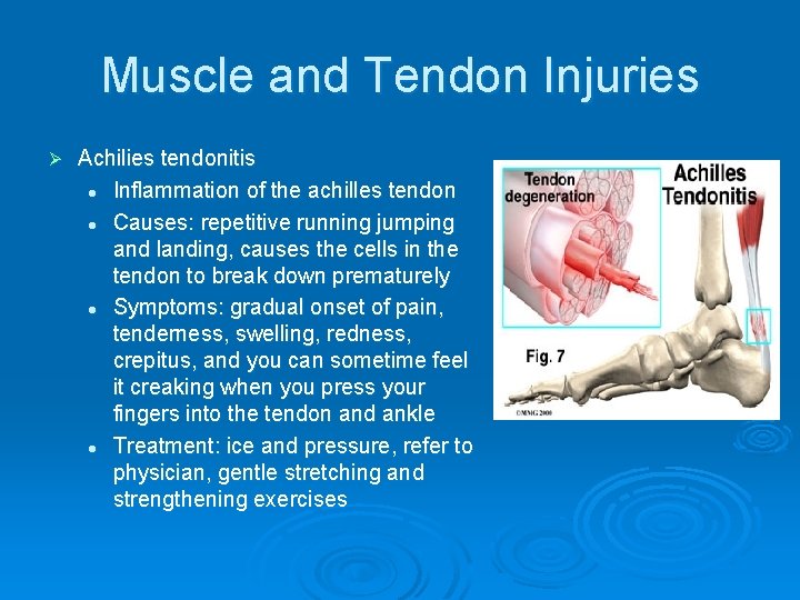 Muscle and Tendon Injuries Ø Achilies tendonitis l Inflammation of the achilles tendon l