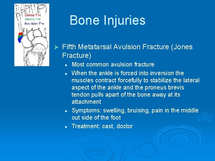 Bone Injuries Ø Fifth Metatarsal Avulsion Fracture (Jones Fracture) l l Most common avulsion