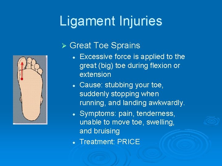 Ligament Injuries Ø Great Toe Sprains l l Excessive force is applied to the