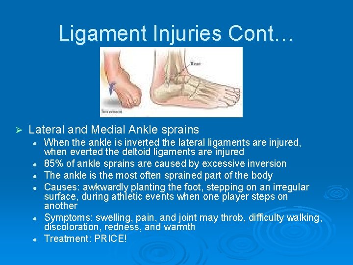 Ligament Injuries Cont… Ø Lateral and Medial Ankle sprains l l l When the