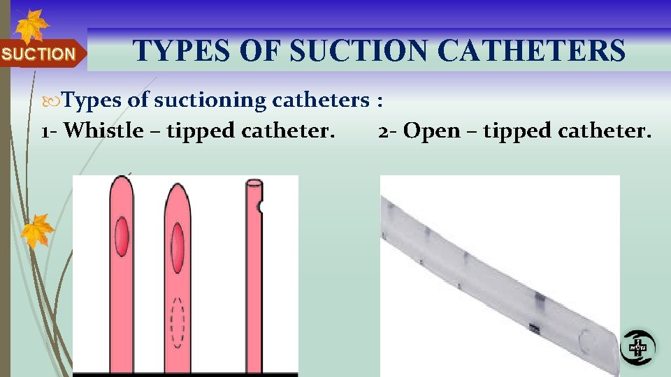 SUCTION TYPES OF SUCTION CATHETERS Types of suctioning catheters : 1 - Whistle –