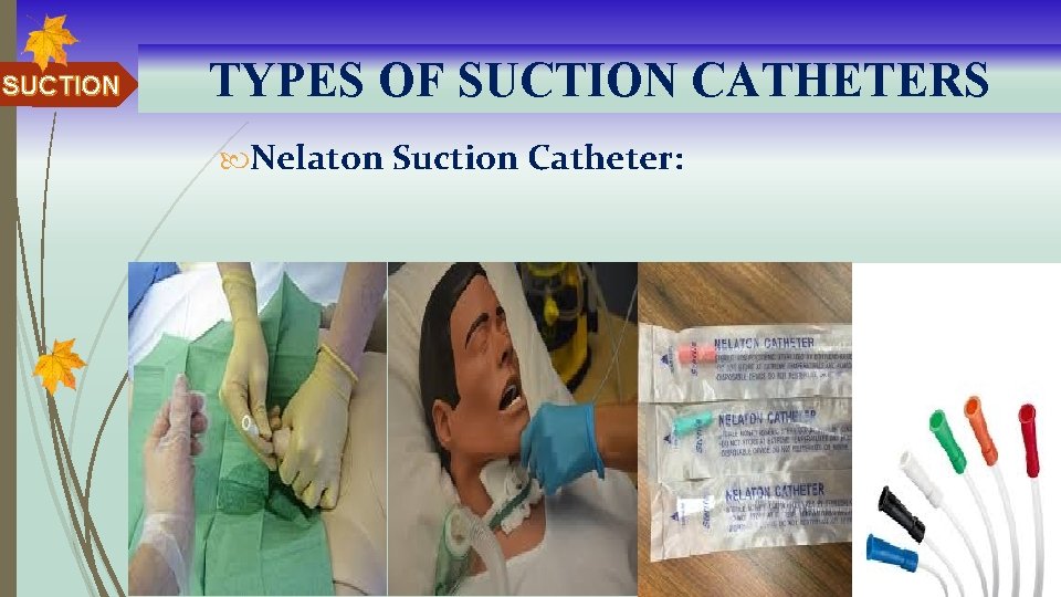 SUCTION TYPES OF SUCTION CATHETERS Nelaton Suction Catheter: 