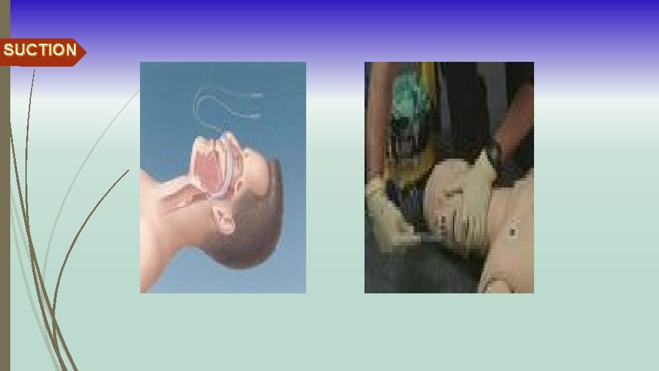 SUCTION 
