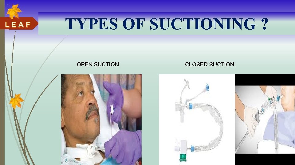 LEAF TYPES OF SUCTIONING ? OPEN SUCTION CLOSED SUCTION 