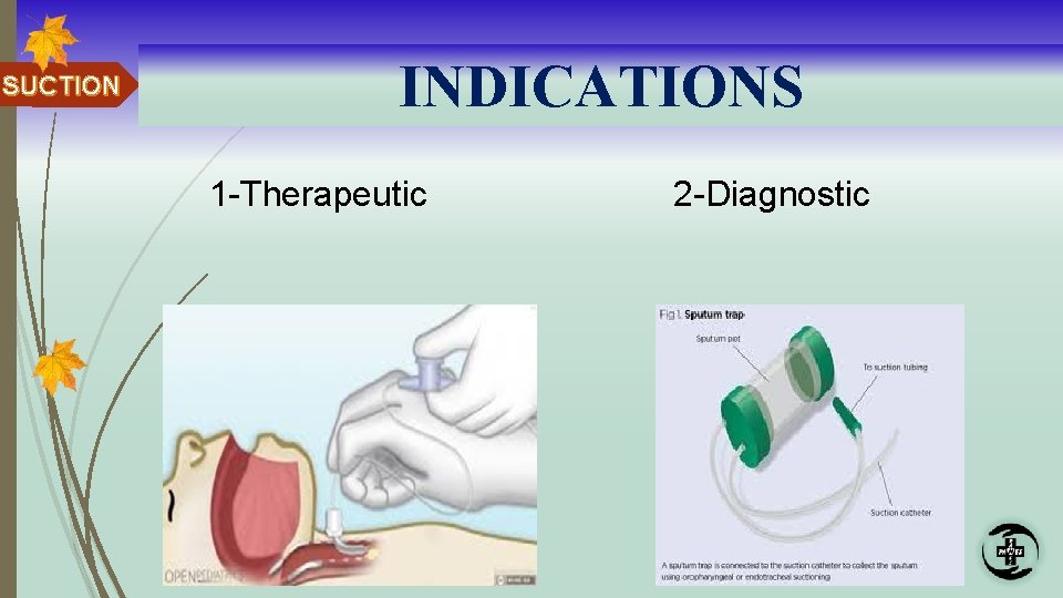 SUCTION INDICATIONS 1 -Therapeutic 2 -Diagnostic 