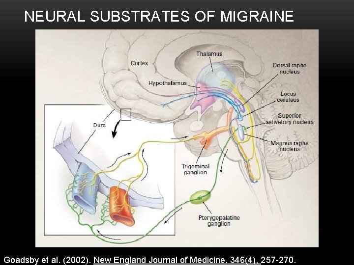 NEURAL SUBSTRATES OF MIGRAINE Goadsby et al. (2002). New England Journal of Medicine, 346(4),