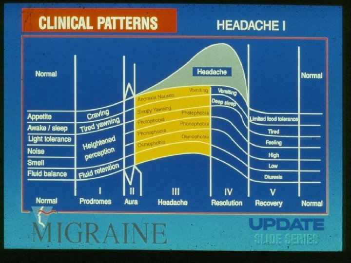 MIGRAINE -VISUAL AURA 
