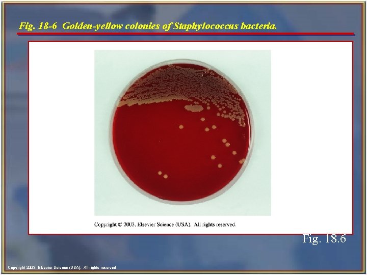 Fig. 18 -6 Golden-yellow colonies of Staphylococcus bacteria. Fig. 18. 6 Copyright 2003, Elsevier