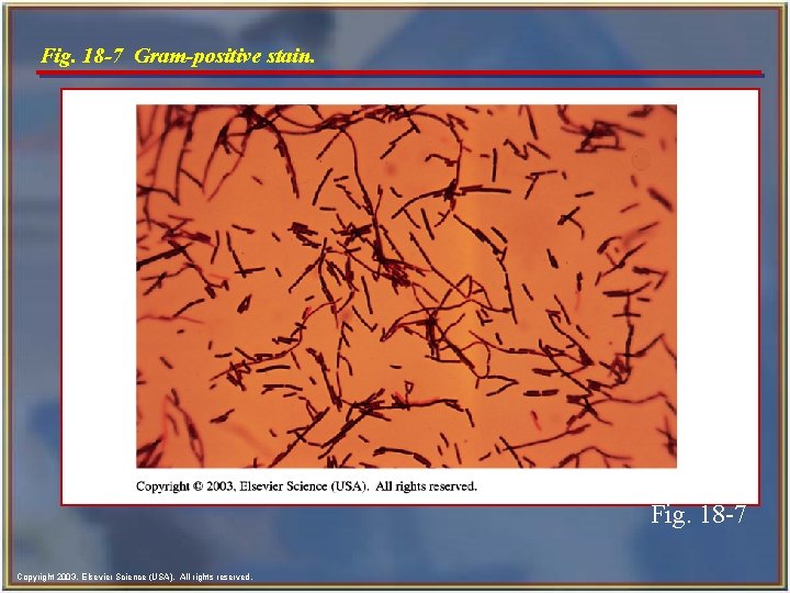 Fig. 18 -7 Gram-positive stain. Fig. 18 -7 Copyright 2003, Elsevier Science (USA). All