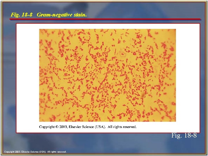 Fig. 18 -8 Gram-negative stain. Fig. 18 -8 Copyright 2003, Elsevier Science (USA). All