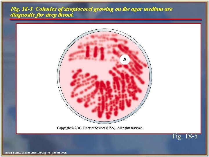 Fig. 18 -5 Colonies of streptococci growing on the agar medium are diagnostic for