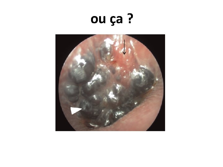 ou ça ? 