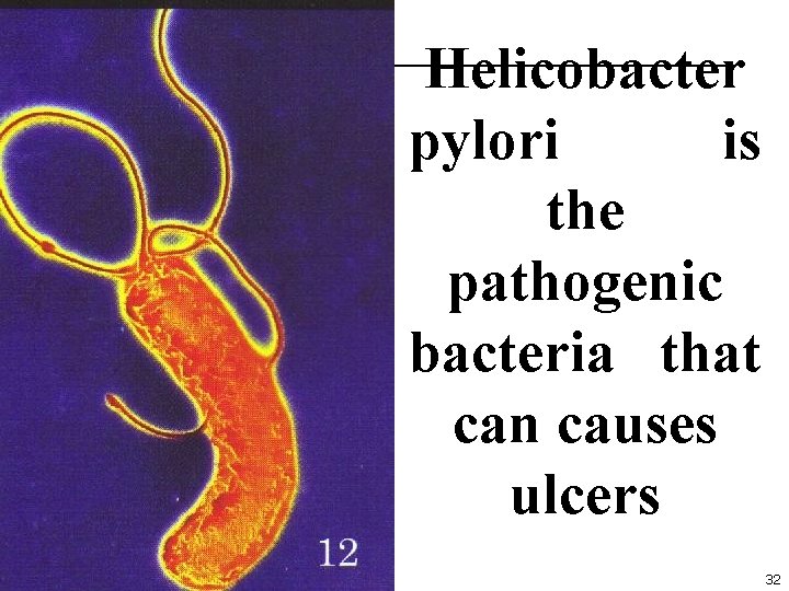 Helicobacter pylori is the pathogenic bacteria that can causes ulcers 32 