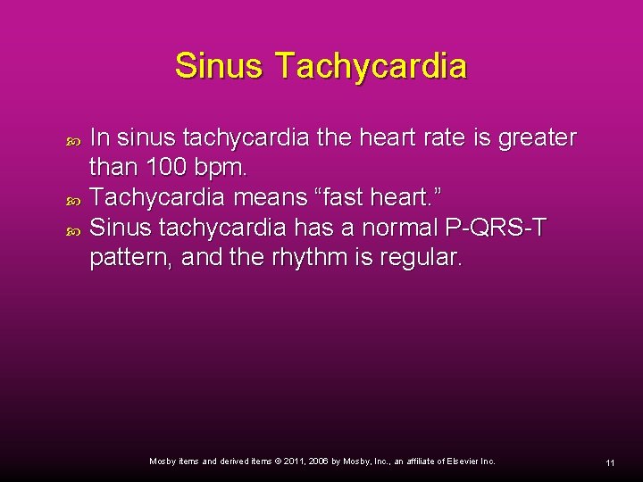 Sinus Tachycardia In sinus tachycardia the heart rate is greater than 100 bpm. Tachycardia