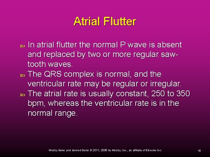 Atrial Flutter In atrial flutter the normal P wave is absent and replaced by