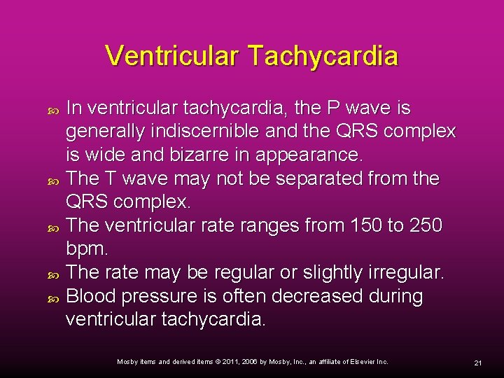 Ventricular Tachycardia In ventricular tachycardia, the P wave is generally indiscernible and the QRS