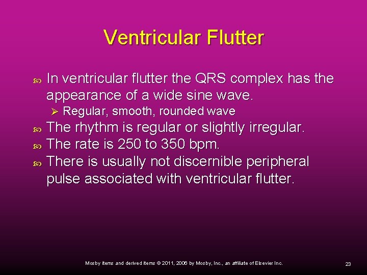 Ventricular Flutter In ventricular flutter the QRS complex has the appearance of a wide