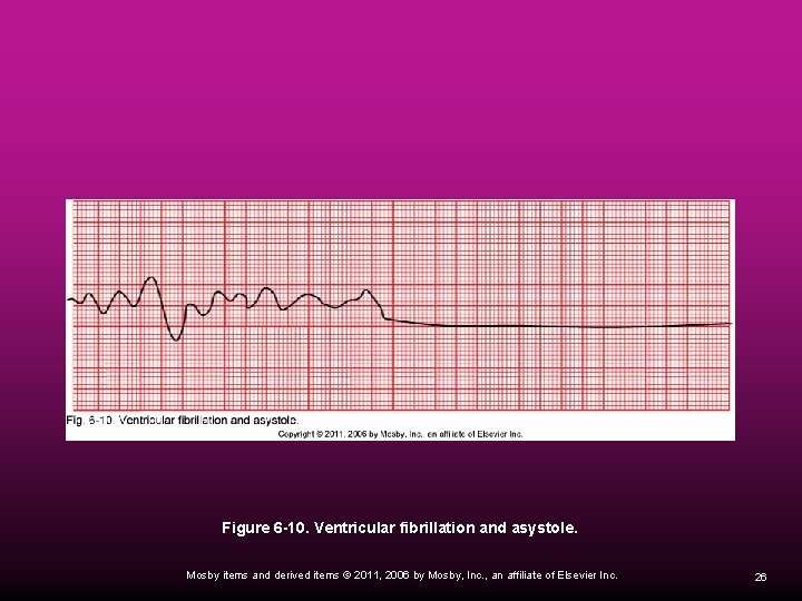 Figure 6 -10. Ventricular fibrillation and asystole. Mosby items and derived items © 2011,