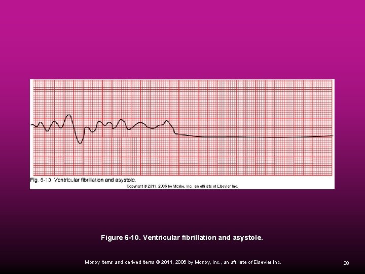 Figure 6 -10. Ventricular fibrillation and asystole. Mosby items and derived items © 2011,