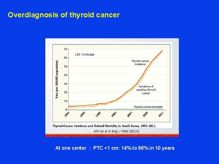 Overdiagnosis of thyroid cancer At one center : PTC <1 cm: 14% to 56%