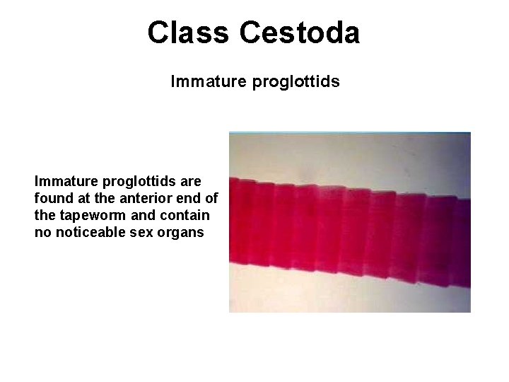 Class Cestoda Immature proglottids are found at the anterior end of the tapeworm and