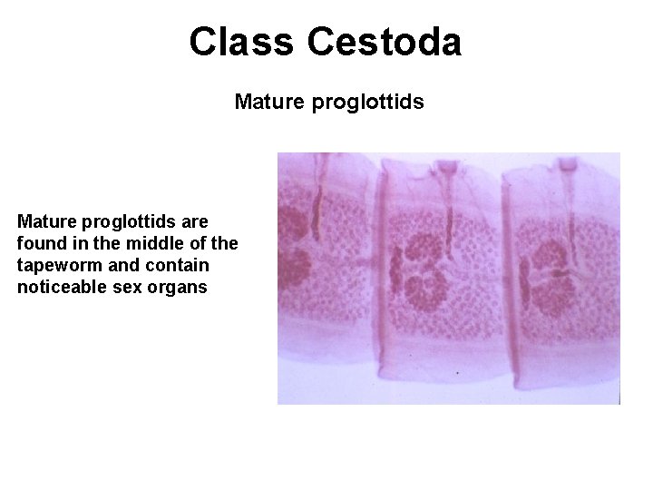 Class Cestoda Mature proglottids are found in the middle of the tapeworm and contain