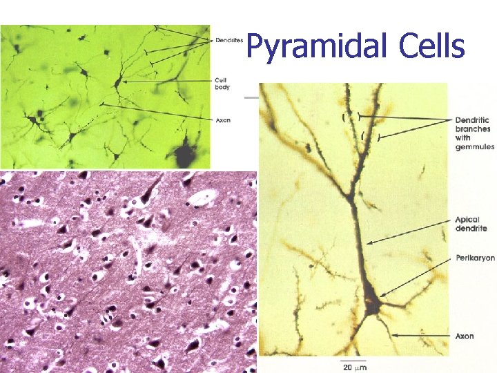 Pyramidal Cells 